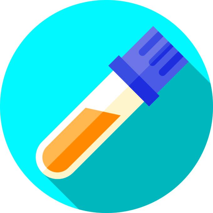 Urine test