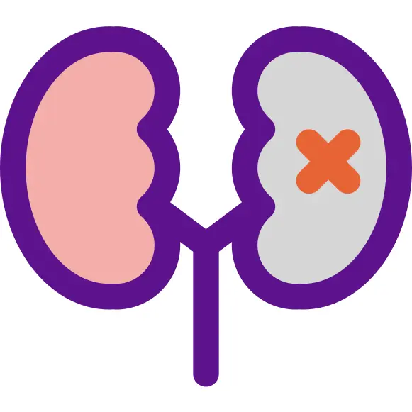 Kidney