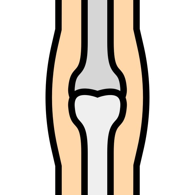 Osteoporosis