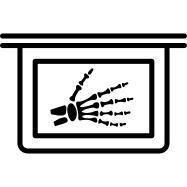 Hand bones in x ray plate