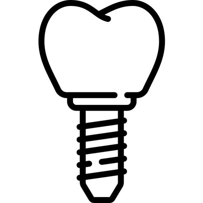 Dental implant