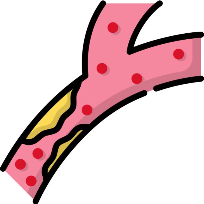Cholesterol