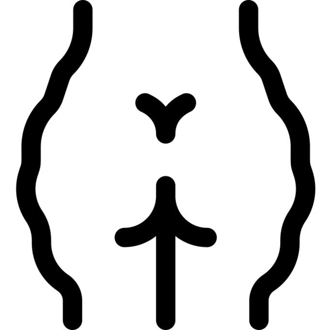 Cellulitis