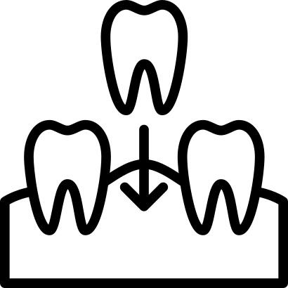 Implants