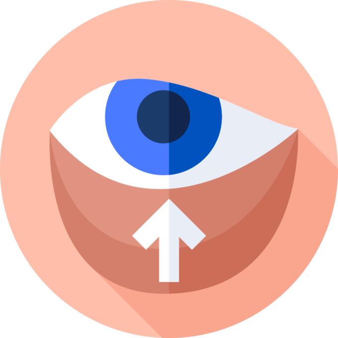 Blepharoplasty