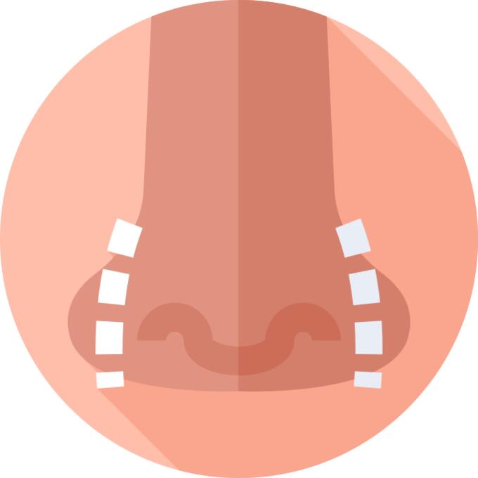 Rhinoplasty