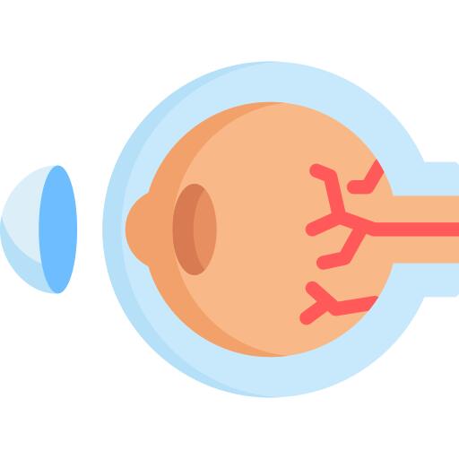 Eye