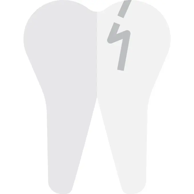 Broken tooth