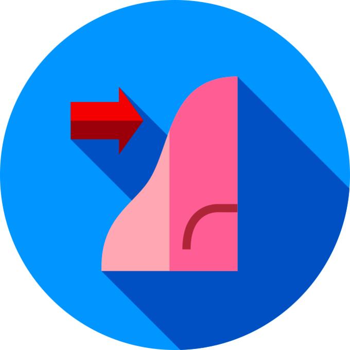 Rhinoplasty