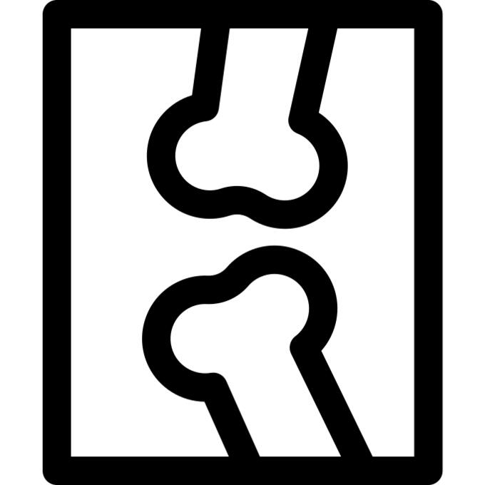 X ray