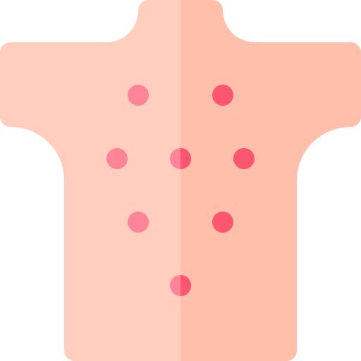 Urticaria