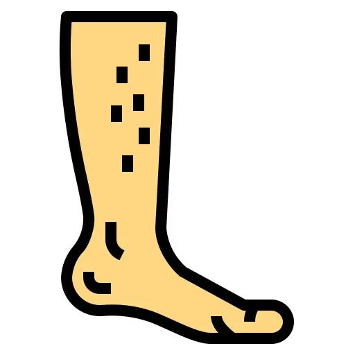 Leg