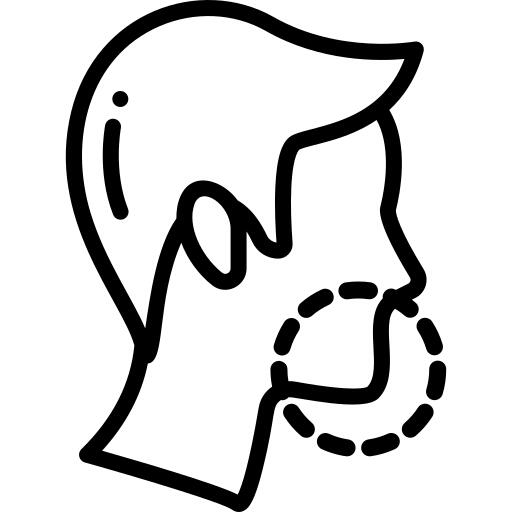 Mentoplasty