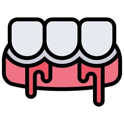 Gingivitis