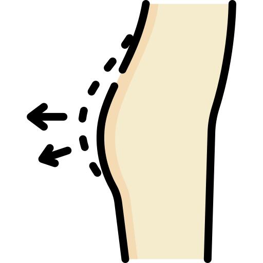 Buttocks