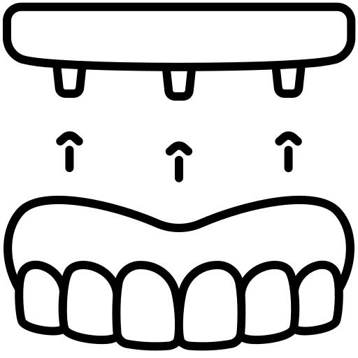 Dental implant