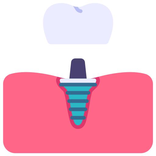 Dental implant