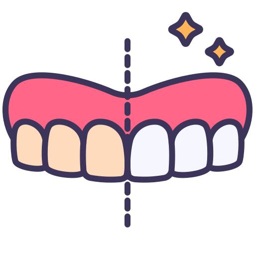 Tooth whitening