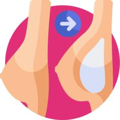 乳房植入物