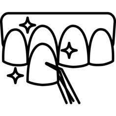 Dental veneer