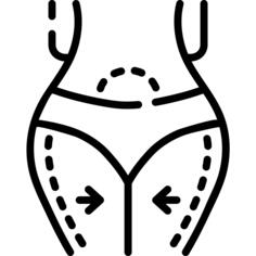 Abdominoplasty