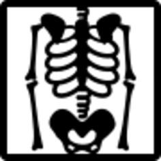 Skeleton view on x ray