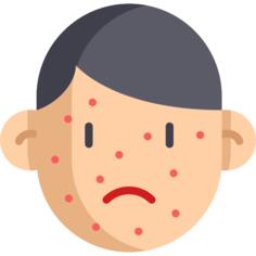 皮疹