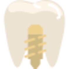 Implants