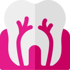 Root canal