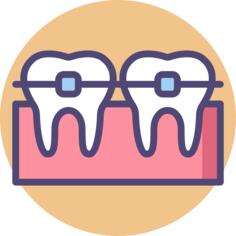 Braces