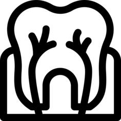 Root canal