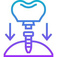 Dental implant