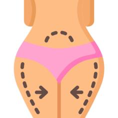 Abdominoplasty