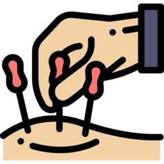 Acupuncture