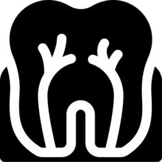 Root canal