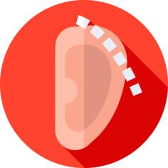 Otoplasty