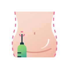 Liposuction