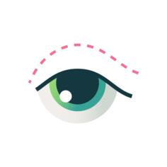 Blepharoplasty