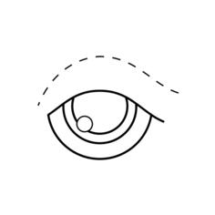 Blepharoplasty
