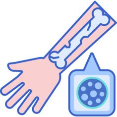 骨质疏松