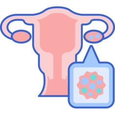 Ovarian cancer