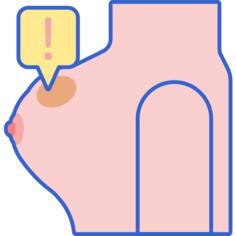 Breast lump