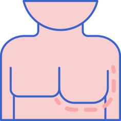 男性乳房发育症