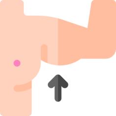 Brachioplasty