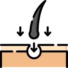 Hair transplant