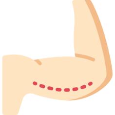 Brachioplasty