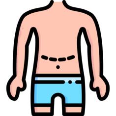 腹部整形