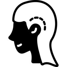 Otoplasty