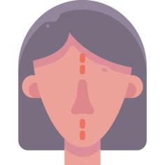 Rhinoplasty