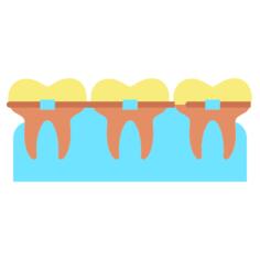 Braces